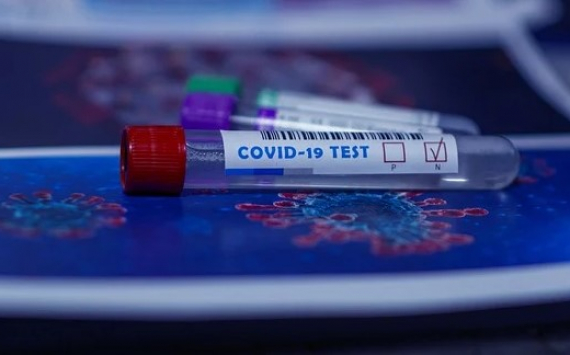 Правительство Иркутской области распорядилось резко увеличить число тестов на COVID-19